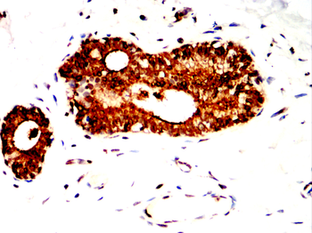 ABCG1 Rabbit Polyclonal Antibody