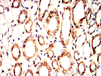 ABCG1 Rabbit Polyclonal Antibody