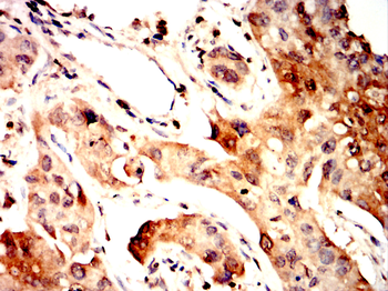 ABCG1 Rabbit Polyclonal Antibody