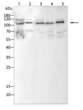ABCG1 Rabbit Polyclonal Antibody