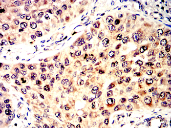CCNE1 Antibody