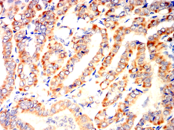 BCL2L1 Antibody
