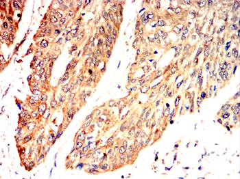 CD27 Antibody