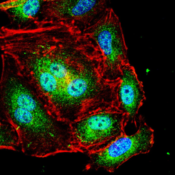 SCGB1A1 Rabbit Polyclonal Antibody