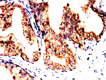 CD36 Antibody