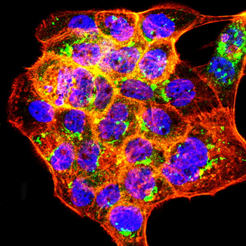 AKT2 Antibody