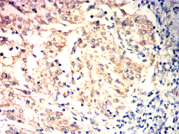 AKT2 Antibody