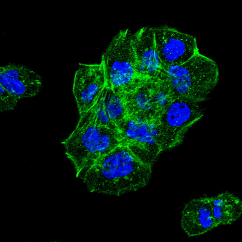 β-Actin Mouse Monoclonal Antibody