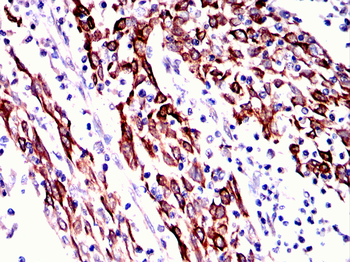 β-Actin Mouse Monoclonal Antibody