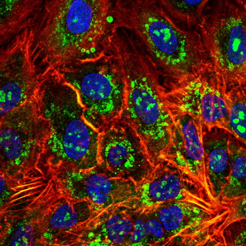 BRAF Antibody