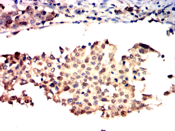 BRAF Antibody