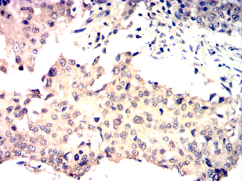 CHEK2 Antibody