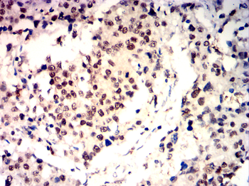 KDM1A Antibody