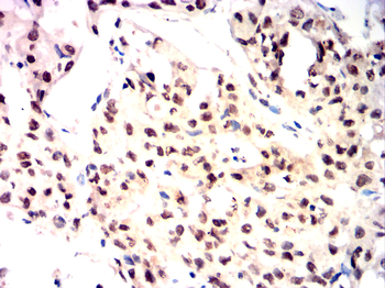 KDM1A Antibody
