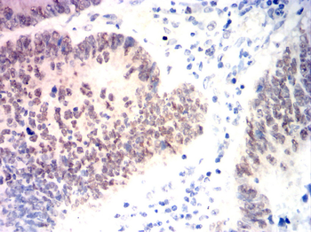 MSH6 Antibody