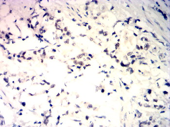 MSH6 Antibody