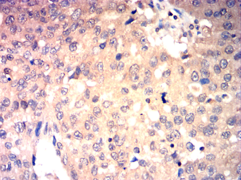 PAK2 Antibody