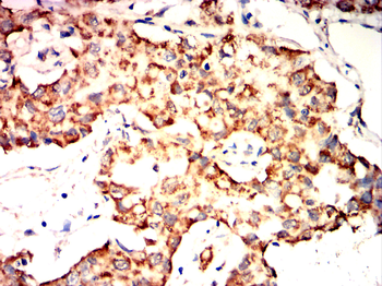 LIMS1 Antibody