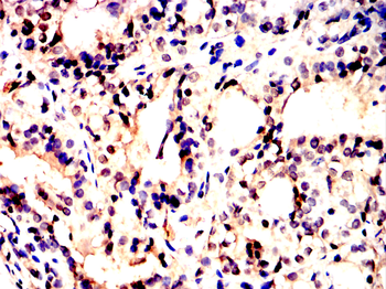 HSPA8 Antibody