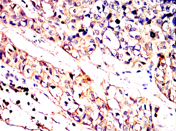 STUB1 Antibody