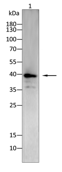 STUB1 Antibody