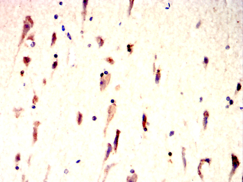 PRKN Antibody