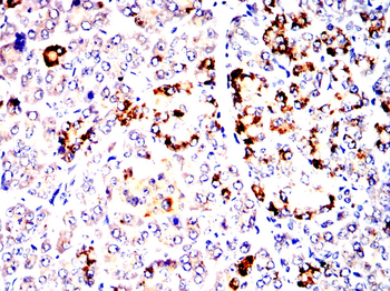 PRKN Antibody