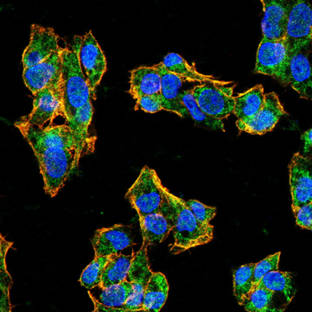 CLDN3 Antibody