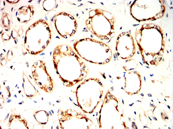 RICTOR Antibody