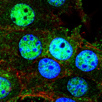UBB Antibody