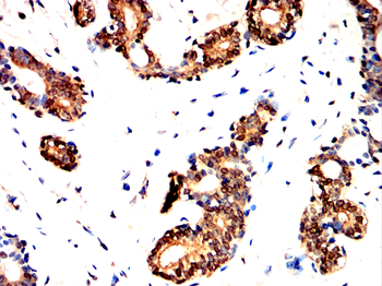 UBB Antibody