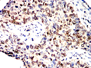 UBB Antibody