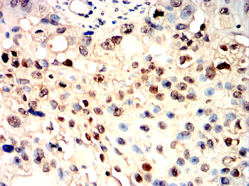 UBB Antibody