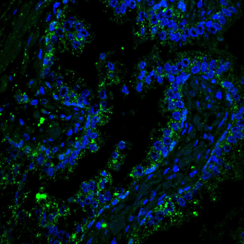 UBB Antibody