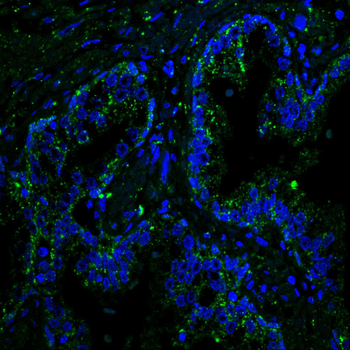 UBB Antibody
