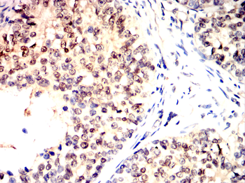 UBB Antibody