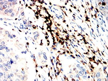 PTPRC Antibody