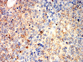 CAV1 Antibody