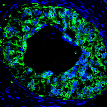 GSTP1 Antibody
