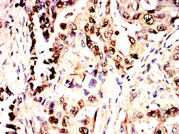 GSTP1 Antibody