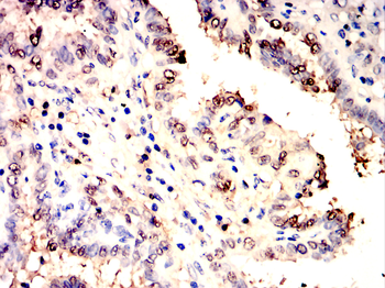 GSTP1 Antibody