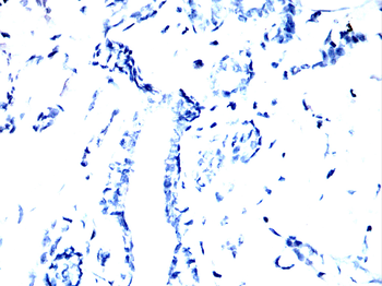 Hemgglutinin Gene Antibody
