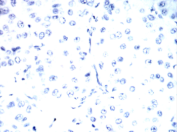 Hemgglutinin Gene Antibody