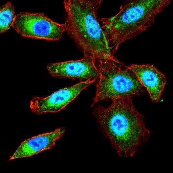 IFNAR1 Rabbit Polyclonal Antibody