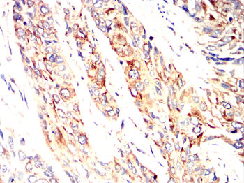 IFNAR1 Rabbit Polyclonal Antibody