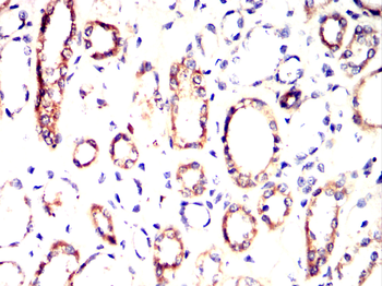 IFNAR1 Rabbit Polyclonal Antibody