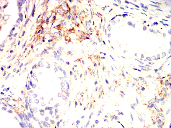 IFNAR1 Rabbit Polyclonal Antibody