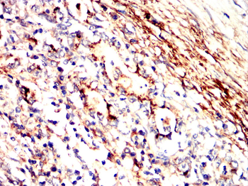 IFNAR1 Rabbit Polyclonal Antibody