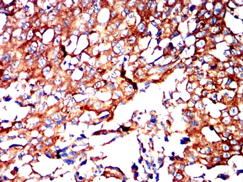 PPIB Antibody