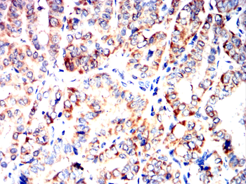 PPIB Antibody